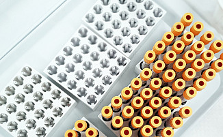 Gesetz für Daten und digitale Innovation im Gesundheitswesen (GeDIG)
